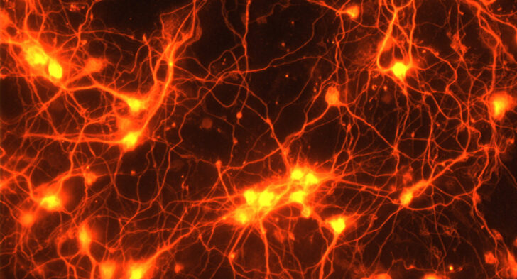 Клетки мозга под микроскопом. Фото NIH Image Gallery (CC BY-NC 2.0)